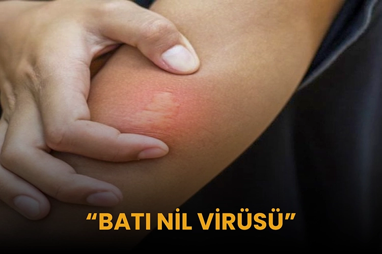 Batı Nil Virüsü Nedir? Belirtileri Nelerdir, Nasıl Bulaşır?